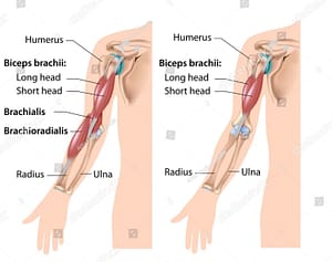 Different biceps muscles
